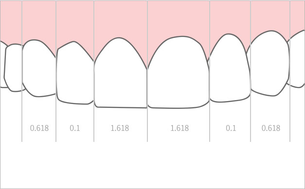 치아 보철물